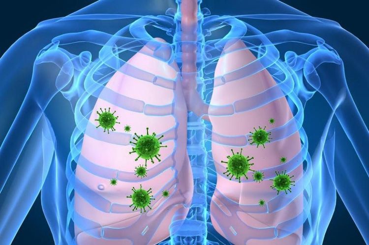 Rhinovirus pneumonia may cause multi-organ failure if not treated early.