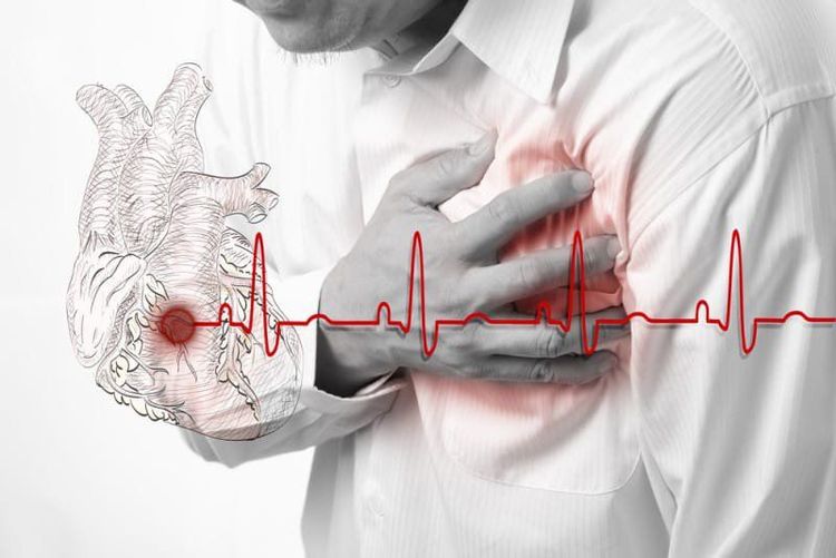 Bệnh nhân suy tim nặng không nên gây tê tủy sống