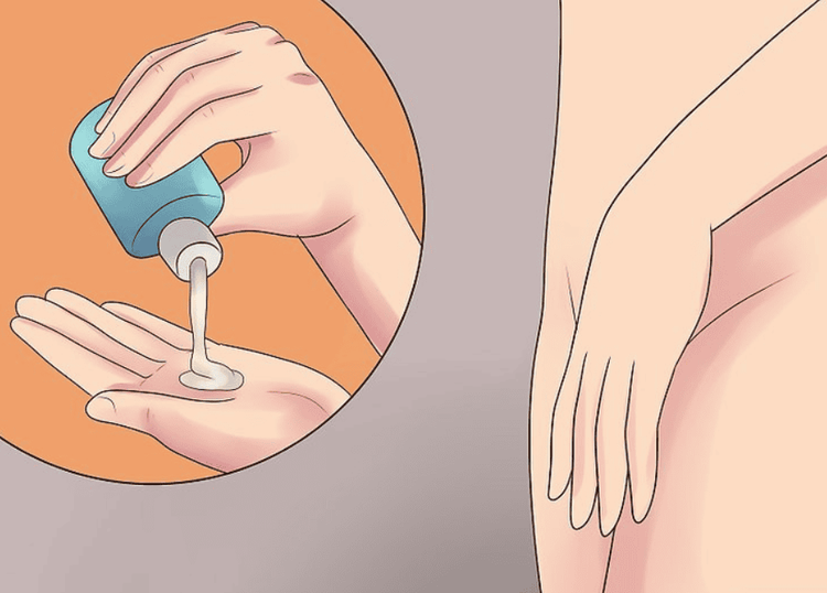 Thorough hygiene and use of prescribed topical antibiotics, will alleviate the severity of acute genital ulcers.