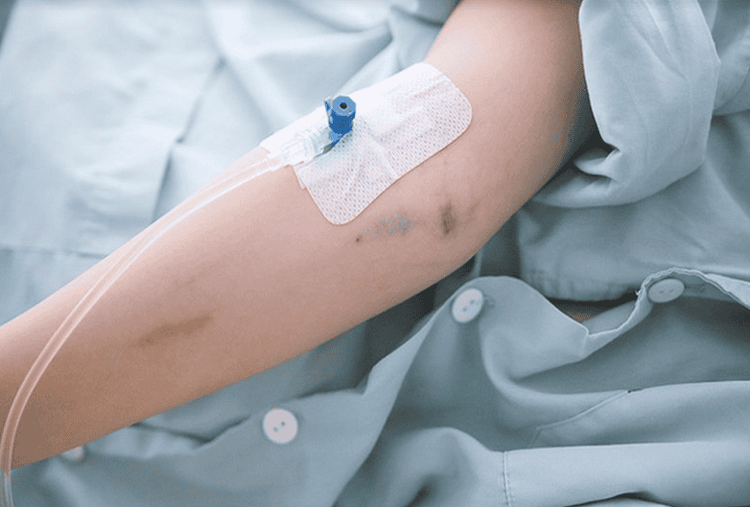 The iodine-containing contrast agents are administered intravenously.