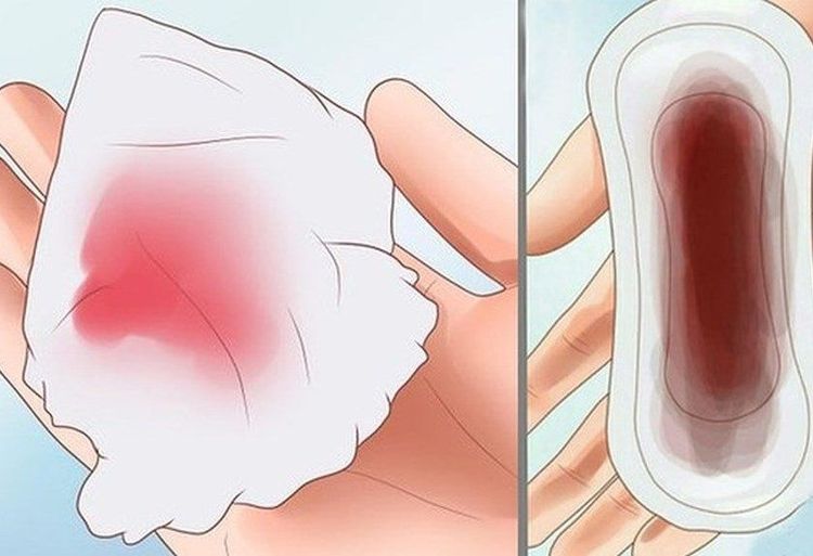 
Chảy máu sau khi uống thuốc tránh thai khẩn cấp có thể do tác dụng phụ của thuốc
