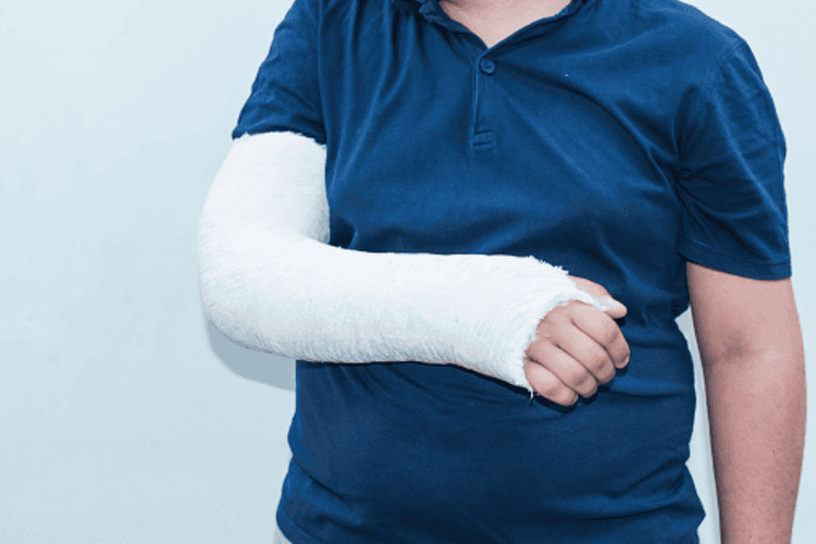 Xét nghiệm được thực hiện trên bệnh nhân bị gãy xương