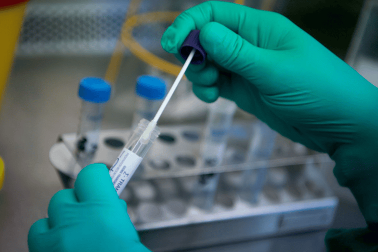 Urethral fluid testing helps treat diseases more accurately
