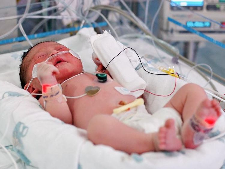 Theo dõi huyết áp của trẻ để có phương án điều trị kịp thời