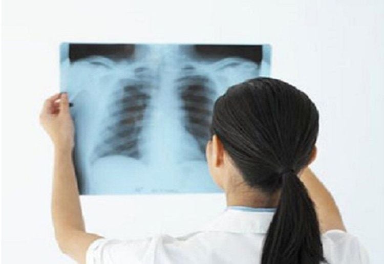 Patients may be prescribed an X-ray to diagnose intercostal neuralgia.