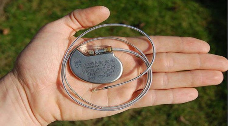 Người bệnh không được mang thiết bị điện tử khi chụp cộng hưởng từ