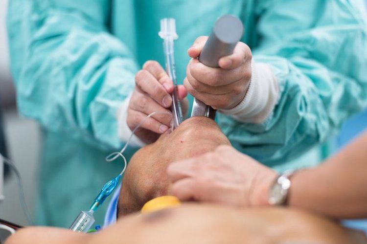 Đặt ống nội khí quản khi người bệnh hoàn toàn ngủ sâu