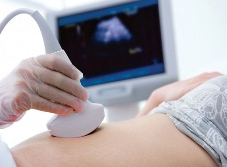 Sản phụ nên siêu âm kiểm tra định kỳ để chẩn đoán bệnh cho trẻ kịp thời