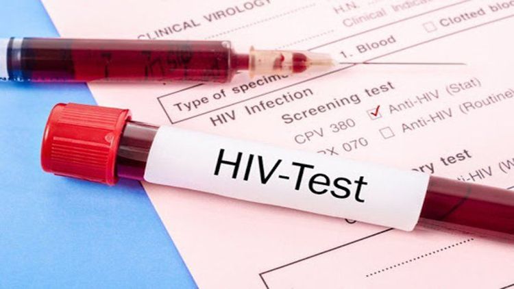 Những người nhiễm HIV rất dễ nhiễm nhiều loại bệnh