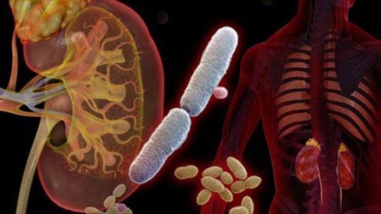 Inflammation of the urinary tract is one of the causes that can cause urine to change color.