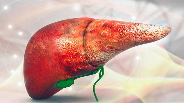 Unhealthy eating habits can damage the liver