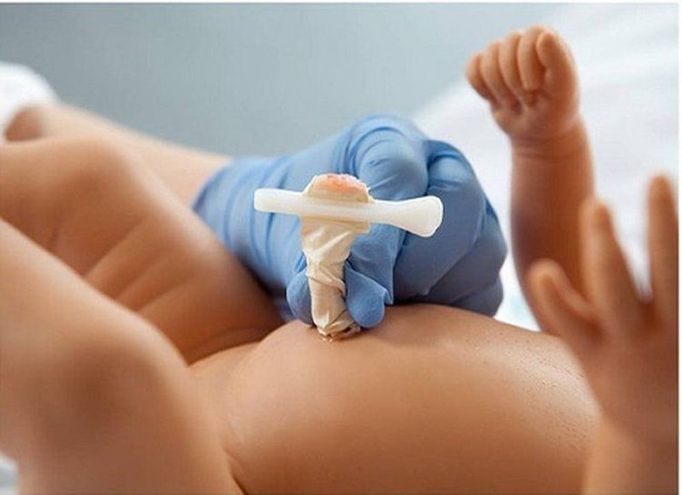 Vắc-xin Infanrix-IPV/Hib giúp phòng ngừa uốn ván rốn ở trẻ