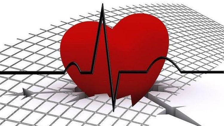 Electrocardiogram is a test for diagnosing cardiac conditions. 
