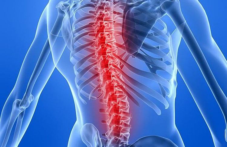 Sử dụng không đúng liều lượng thuốc có thể khiến gãy xương cột sống