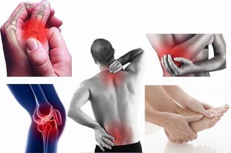 Viêm khớp dạng thấp gây sưng đau các khớp