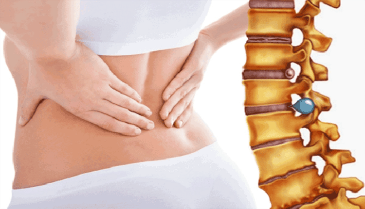 Spinal degeneration increases the risk of secondary intercostal neuralgia.