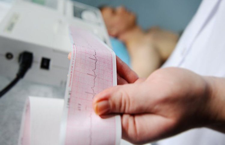 An electrocardiogram (ECG) is a method to diagnose arrhythmias.