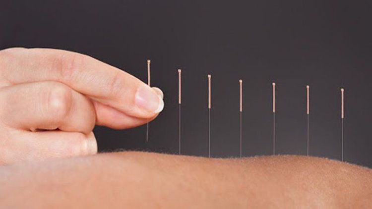 Sau khi châm cứu bạn sẽ thấy thư giãn và đầy sinh lực