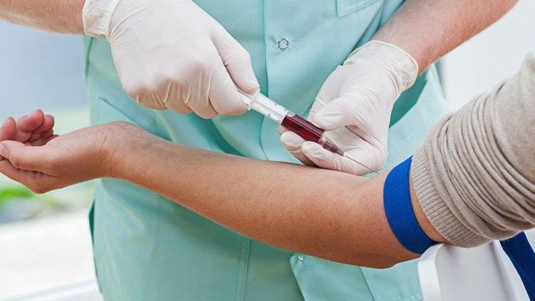Mẫu bệnh phẩm được sử dụng thường là máu tĩnh mạch