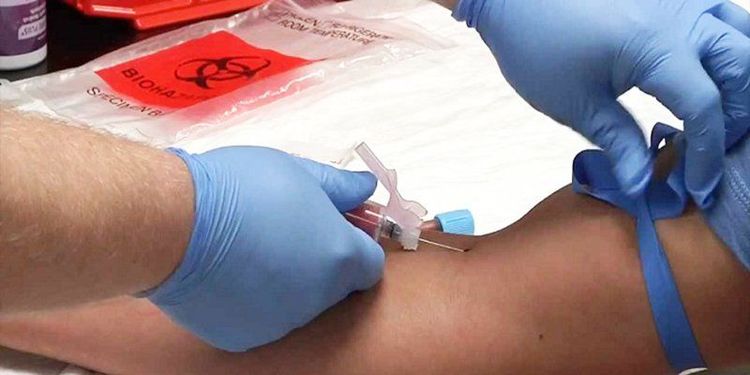 Remind the patient to relax their hand when removing the tourniquet.