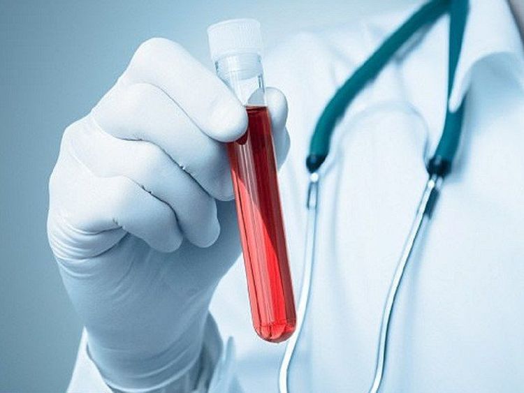 Xét nghiệm máu giúp chẩn đoán bệnh liên quan đến thay đổi tinh hoàn
