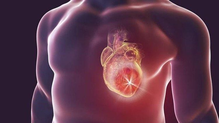 Bệnh basedow có thể gây ra biến chứng suy tim sung huyết ở người bệnh