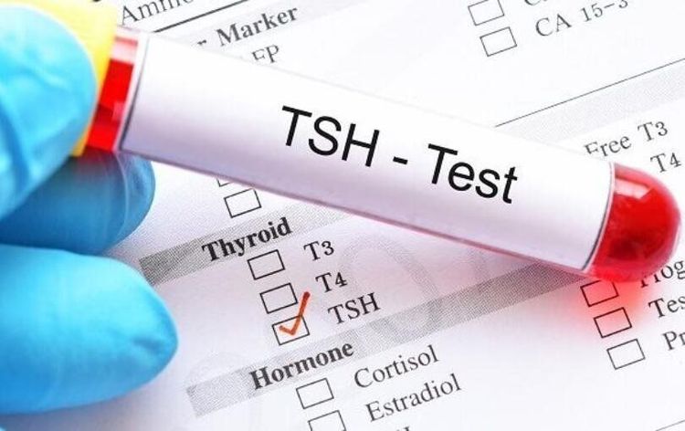 Stress làm giảm nồng độ hormone TSH trong máu khiến hoạt động của tuyến giáp rối loạn.