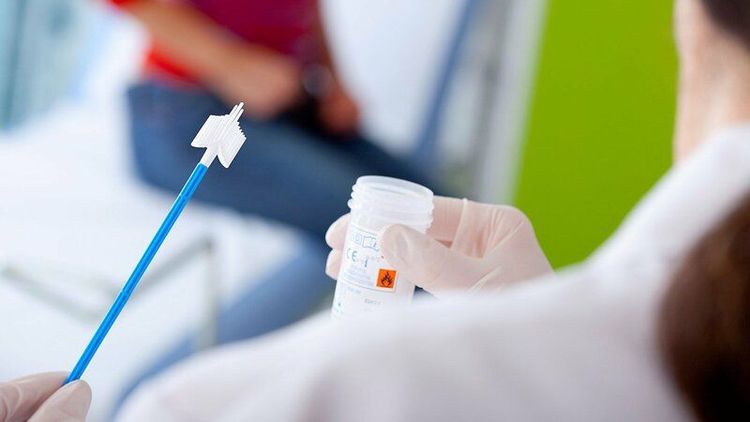 Dự phòng cấp 2, bác sĩ có thể chỉ định các xét nghiệm giúp sàng lọc sớm