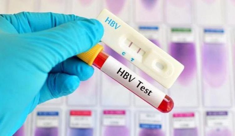 Xét nghiệm HBsAg là một trong các xét nghiệm viêm gan B.