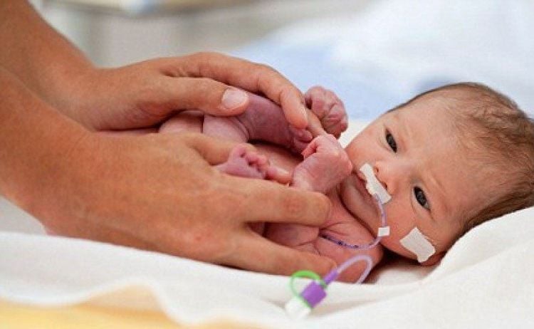 Extremely preterm infants have a higher risk of complications, including respiratory distress syndrome (RDS)
