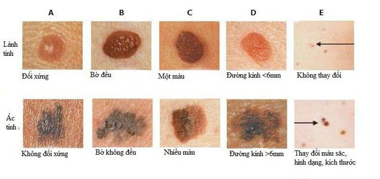Tomatoes play a role in preventing skin cancer