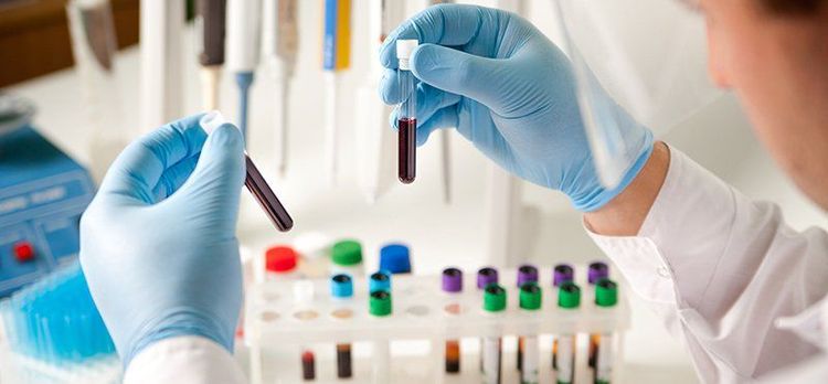 Tiến hành các xét nghiệm cận lâm sàng để chẩn đoán chính xác hội chứng Serotonin do thuốc