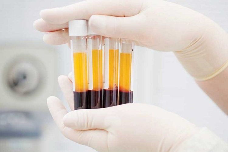 Huyết tương giàu tiểu cầu (PRP) có rất nhiều công dụng