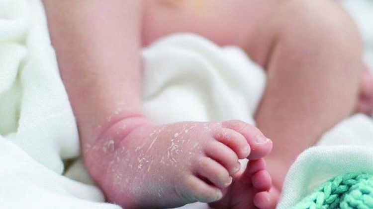 Da khô ở trẻ có thể là biểu hiện của một số bệnh di truyền