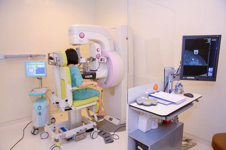 Bạn nên chụp X-quang tuyến vú thường xuyên sau tuổi 50 đến 75