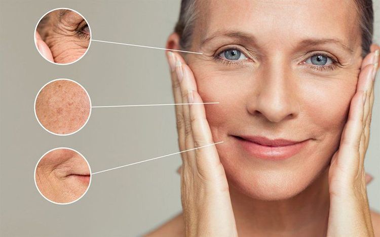 
Lão hóa khiến da xuất hiện nhiều nếp nhăn ở quanh vùng mắt, má, miệng,...
