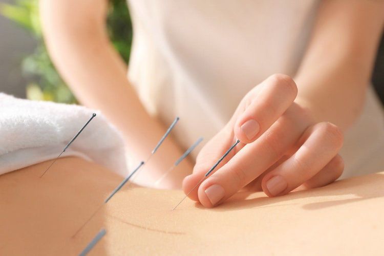 Châm cứu giúp cân bằng dòng chảy của năng lượng