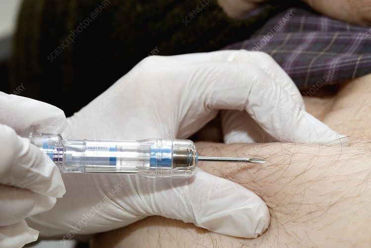 Thuốc Goserelin Implant được sử dụng theo chỉ dẫn của bác sĩ