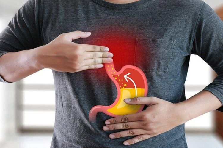 Ợ hơi quá mức có thể đi kèm với cả bệnh trào ngược dạ dày thực quản (GERD) và chứng khó tiêu chức năng.