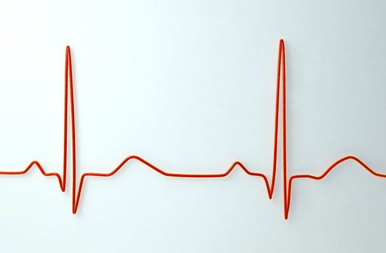 Slow heart rate is one of the common side effects of Nimodipine 