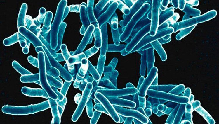 Mycobacterium tuberculosis are the main cause of cervical tuberculous lymphadenitis.
