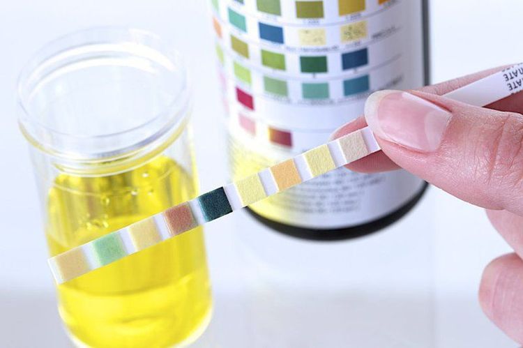 Postoperative urine assessment is very important for patient monitoring and care