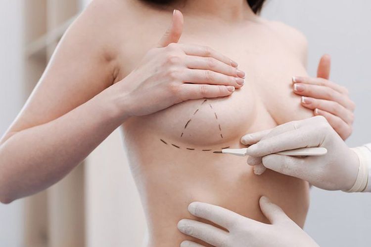 Một số ít gặp tình trạng nâng ngực có làm mất cảm giác