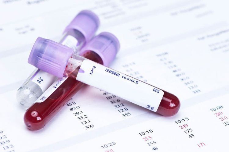 A blood test is the most reliable way to diagnose hypochloremia.