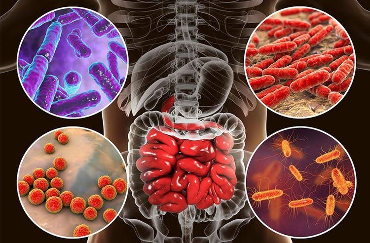 Hệ vi khuẩn ruột non phát triển quá mức có thể gây ra bệnh ở ruột non