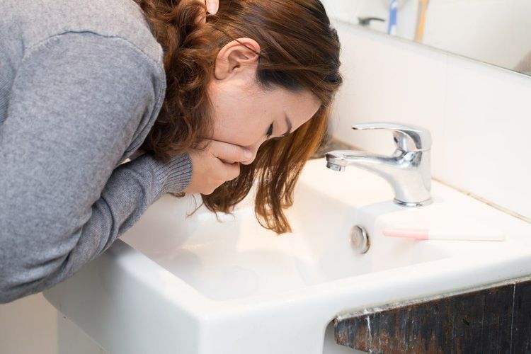 Buồn nôn, nôn ói nhiều là dấu hiệu nhận biết loét dạ dày cấp.