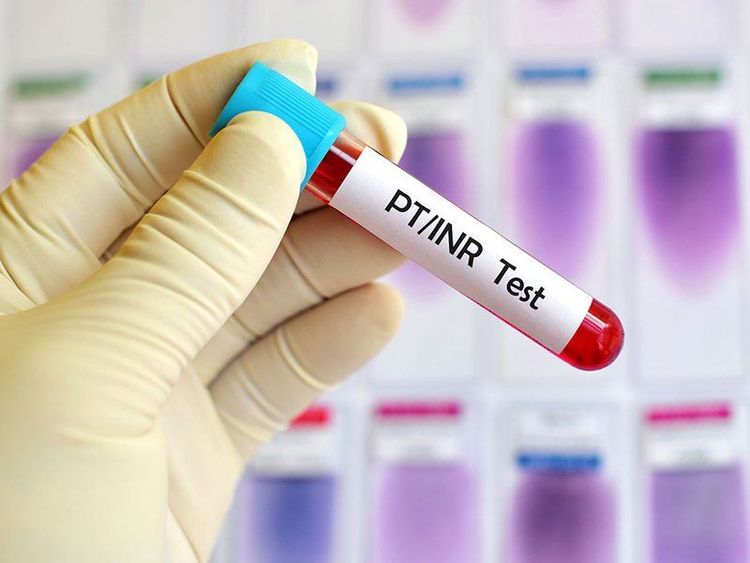 PT-INR là một trong các các chỉ số xét nghiệm đông máu