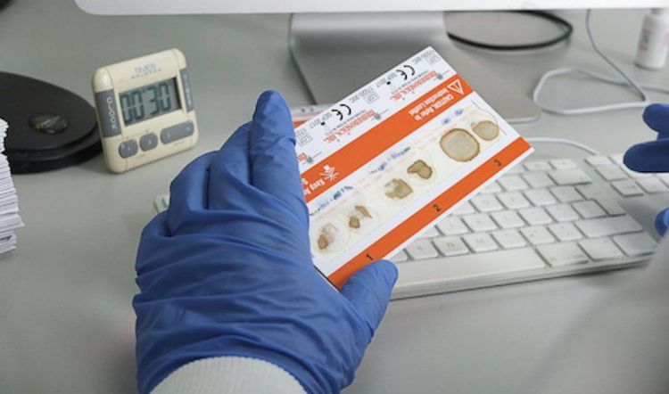 Xét nghiệm phân có thể xác định sự chảy máu đường tiêu hóa