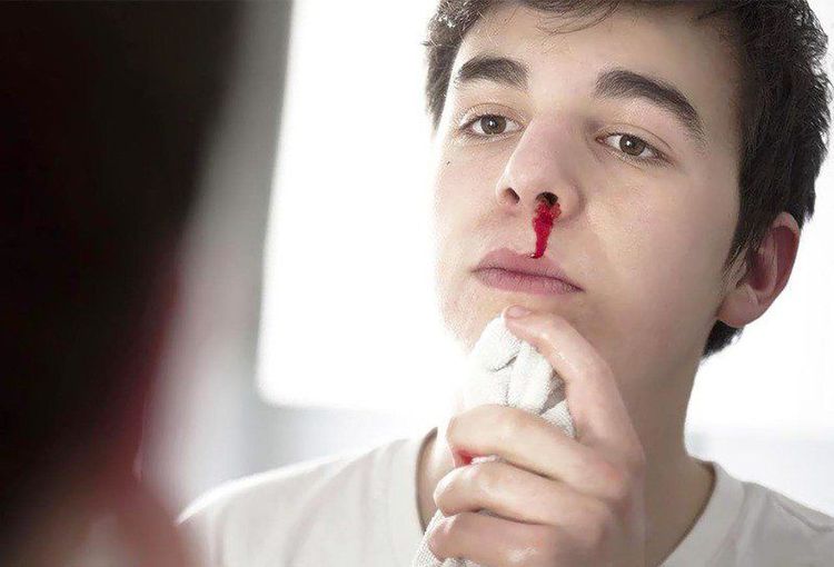 Một tác dụng toàn thân của hiệp bạch huyệt chính là điều trị bệnh chảy máu mũi