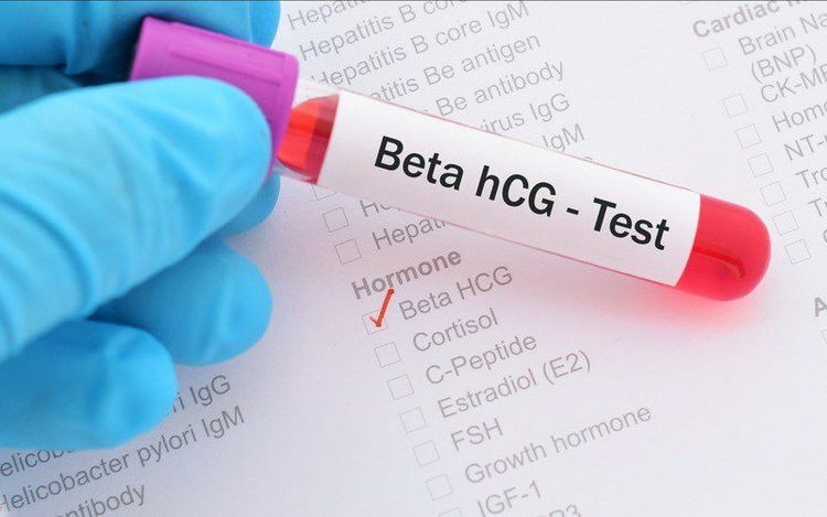 The β-hCG concentration is related to the question